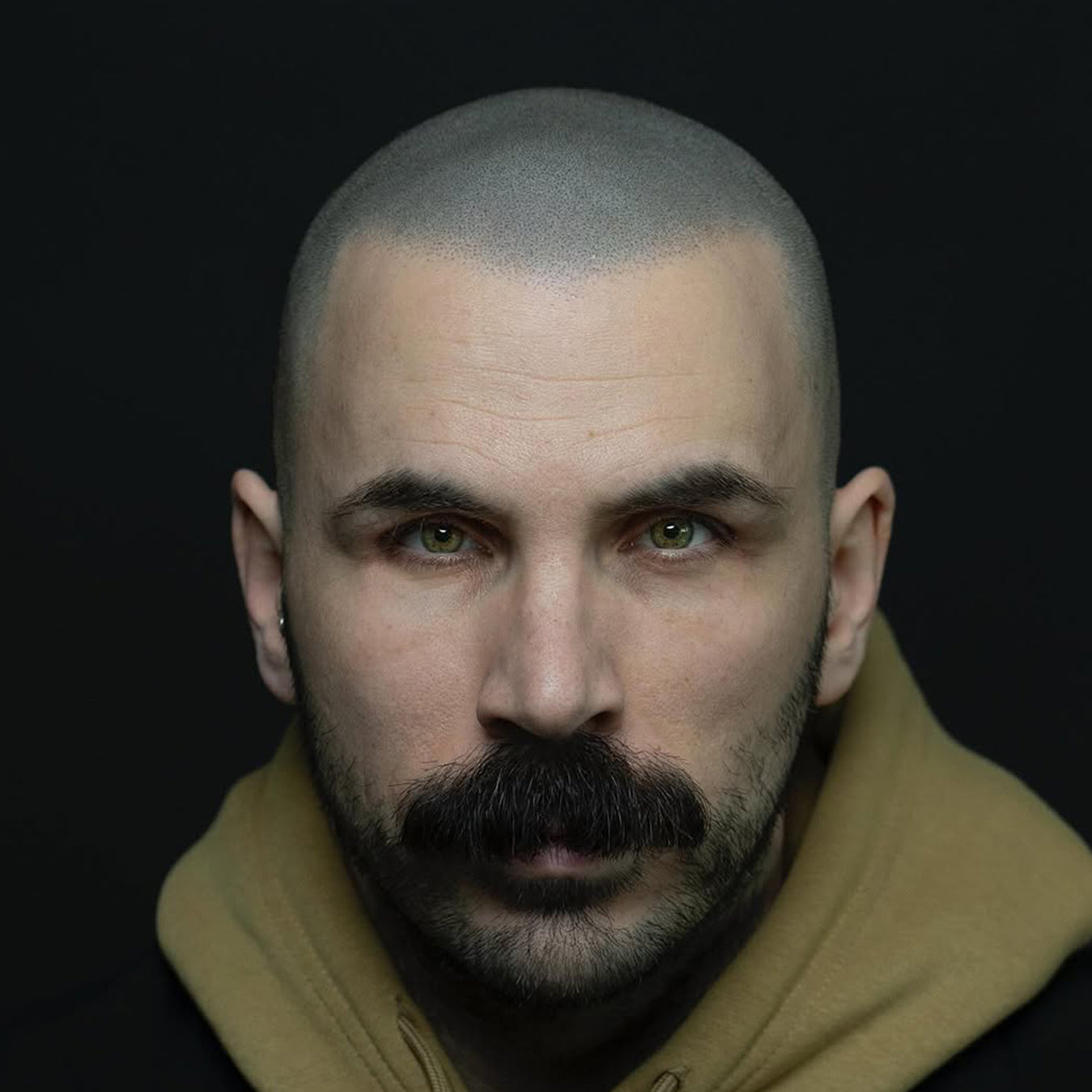 Scalp micropigmentation, side effects